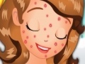 Hra Sofia Squeeze Pimples