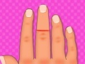 Hra Finger surgery