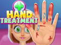 Hra Hand Treatment