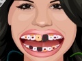 Hra Selena Gomez Perfect Teeth 
